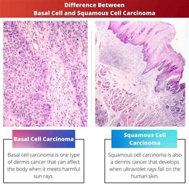 Are basal cell and squamous cell carcinomas painful?