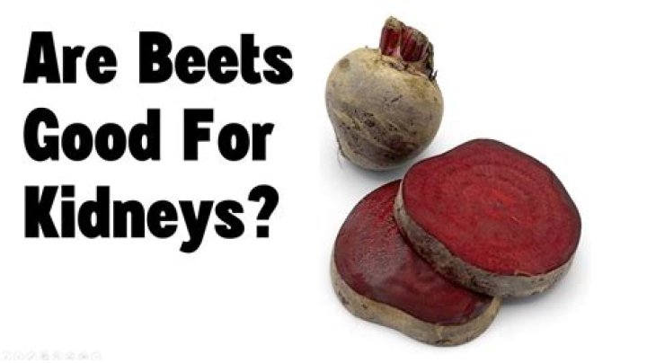 Are beets bad for kidney stones?