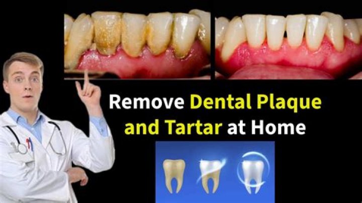 Are home plaque removers safe?