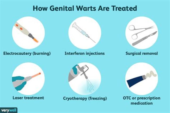 Are HPV and genital warts the same thing?