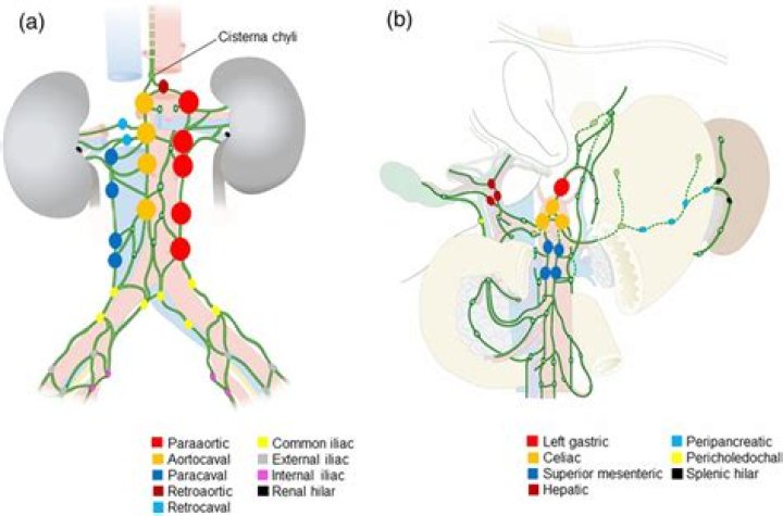 Are metastatic nodes movable?