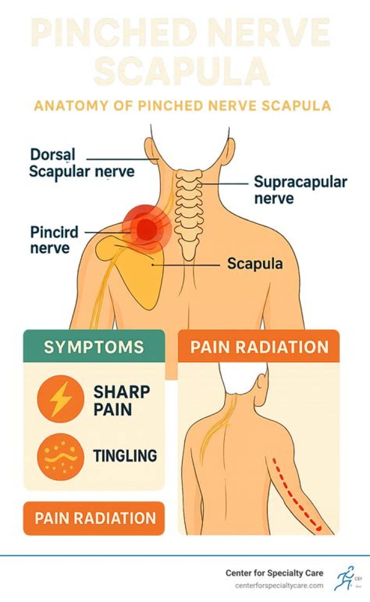 Are muscle relaxers good for pinched nerves?