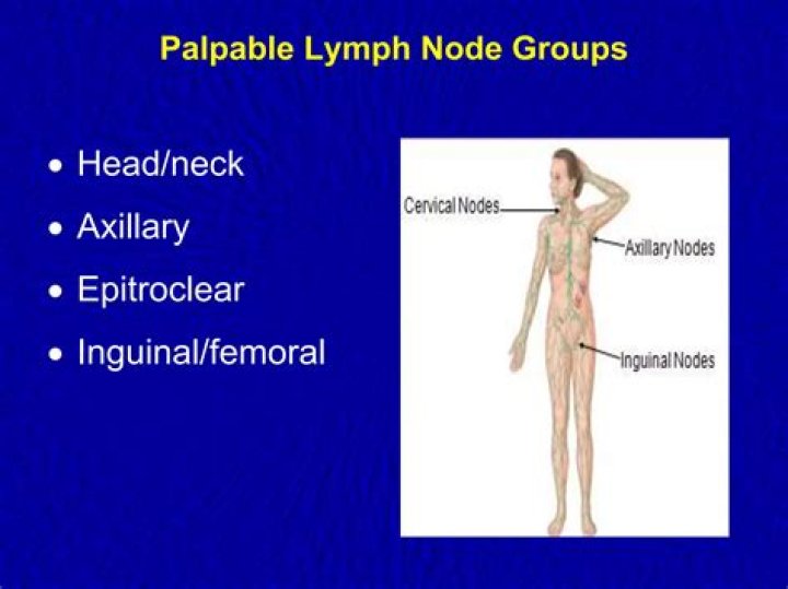 Are normal lymph nodes palpable?