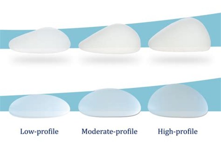 Are you happy with your breast implants?