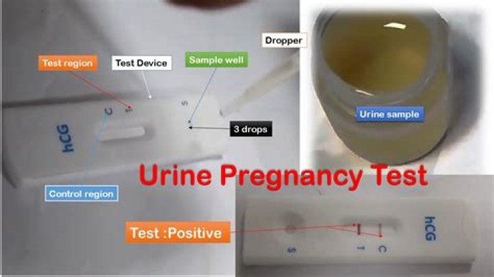 Can a urine pregnancy test tell you how far along you are?