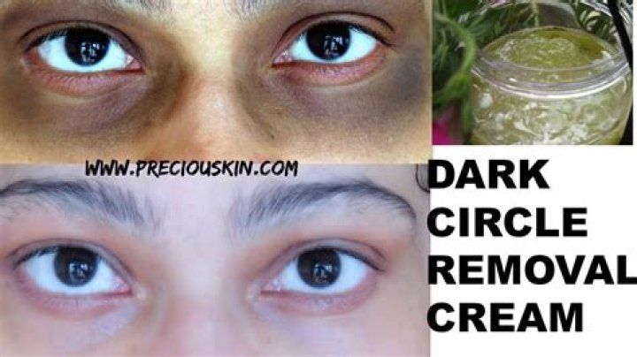 Can aloe vera lighten dark circles?