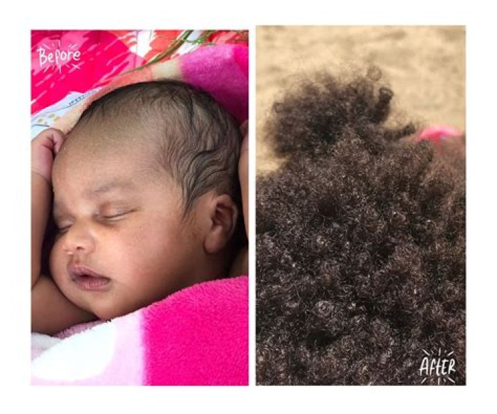 Can babies get white hair?