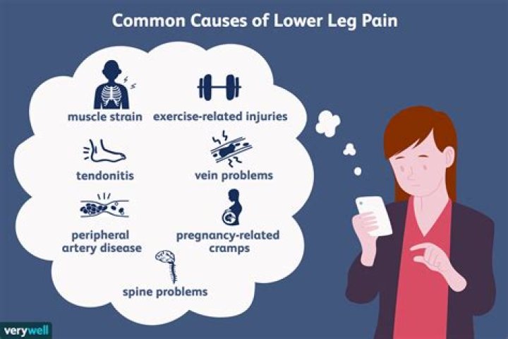 Can back issues cause leg pain?
