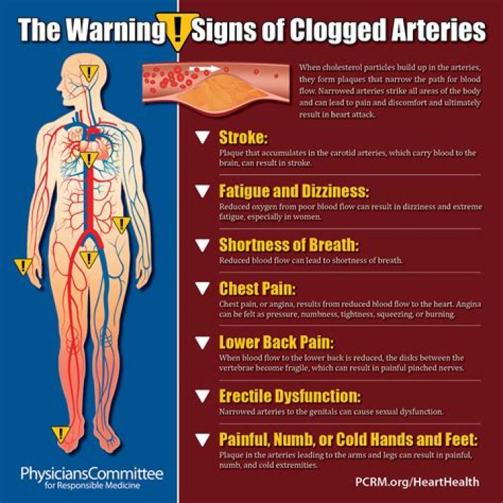 Can blocked arteries cause sweating?