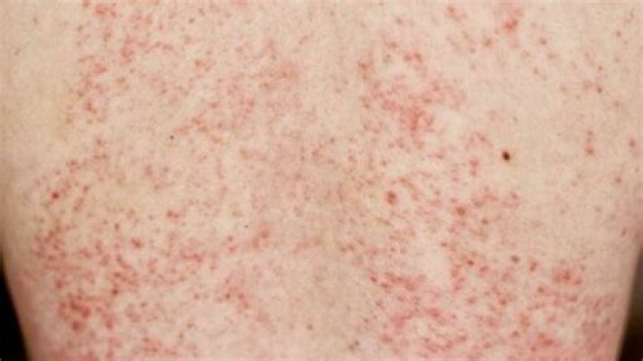 Can blood disorders cause itchy skin?