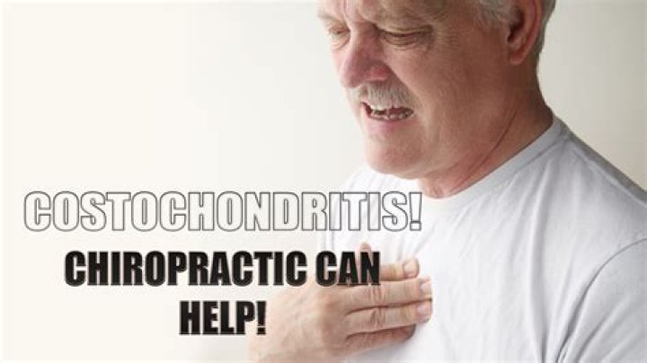Can chiropractors help costochondritis?