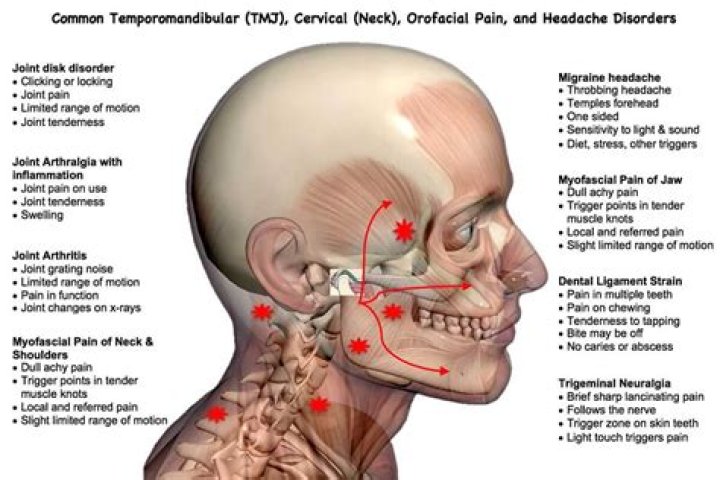 Can face muscles cause tooth pain?