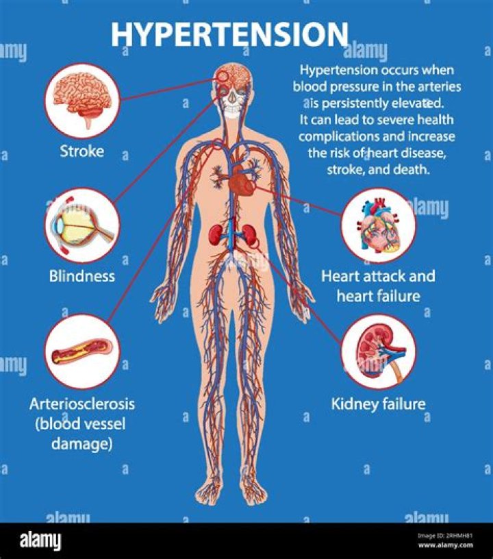 Can fat cause hypertension?