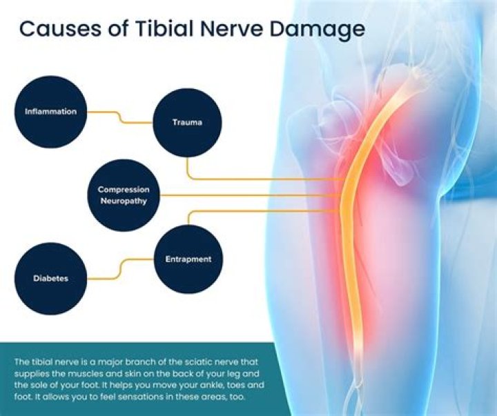 Can fillings cause nerve damage?