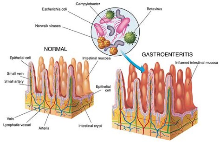 Can gastro last more than a week?