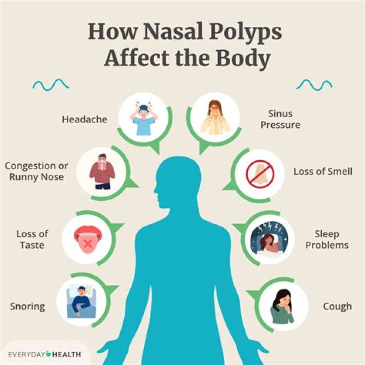 Can HPV cause nasal polyps?
