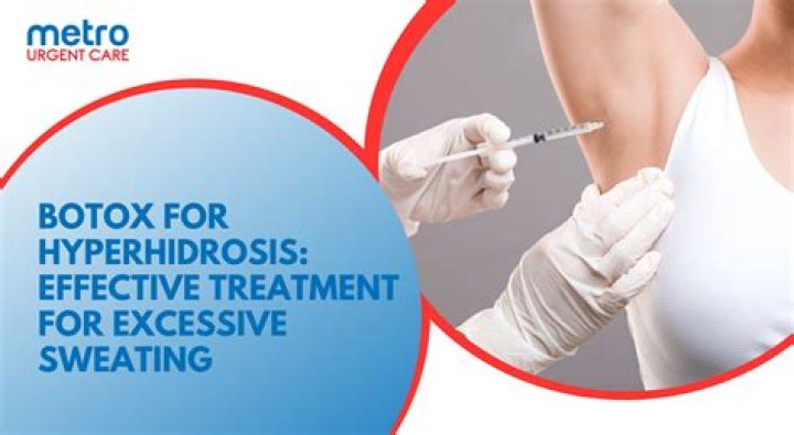 Can I get Botox for hyperhidrosis on the NHS?