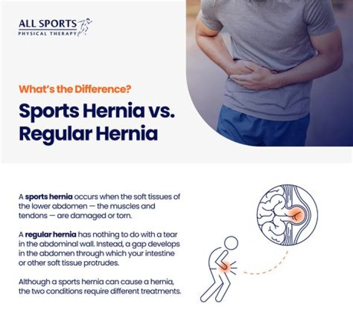 Can I still run with a sports hernia?