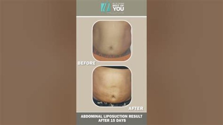 Can I take Lipo 6 without working out?