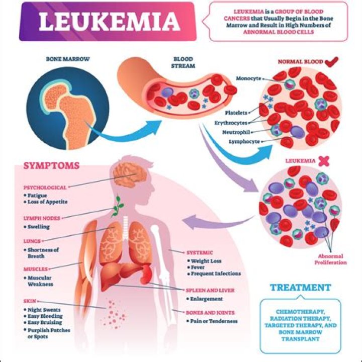 Can leukemia go undiagnosed?