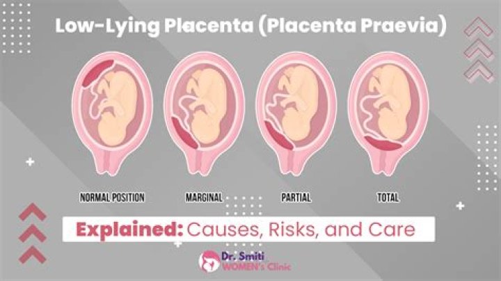 Can low lying placenta move up after 32 weeks?