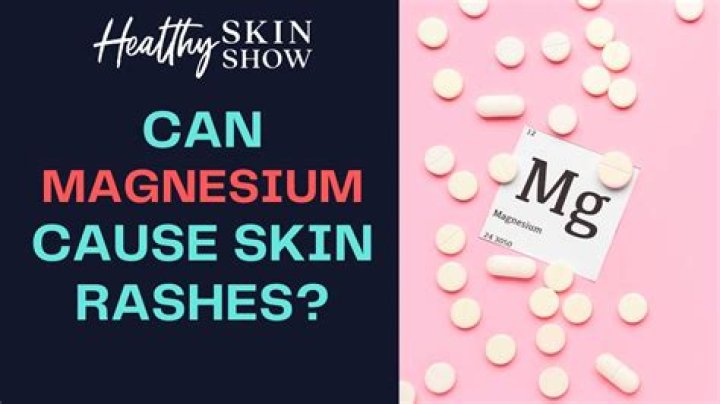 Can magnesium cause eczema?
