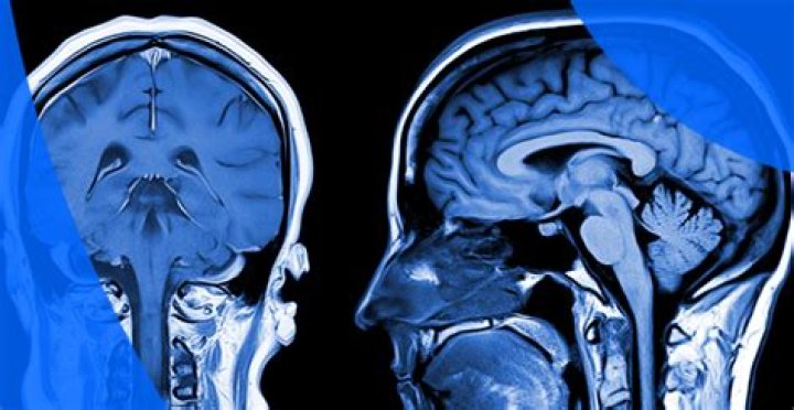 Can MRI techs read results?