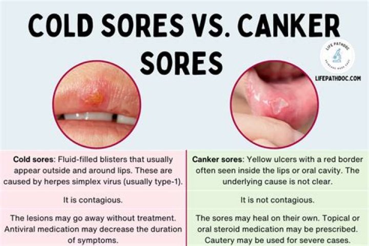 Can pets get cold sores?
