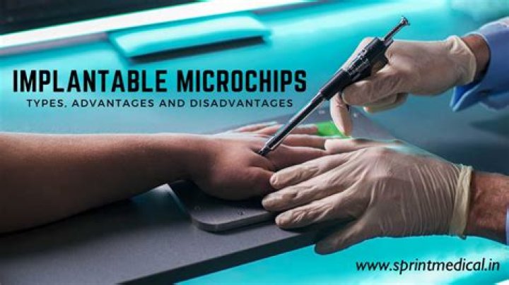 Can phones scan microchips?