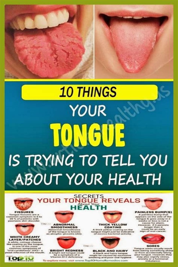 Can salt irritate your tongue?