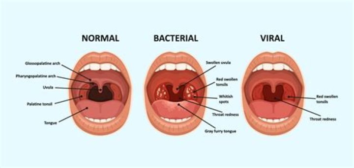 Can strep go into the bloodstream?