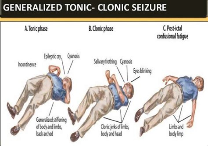 Can supplements cause seizures?