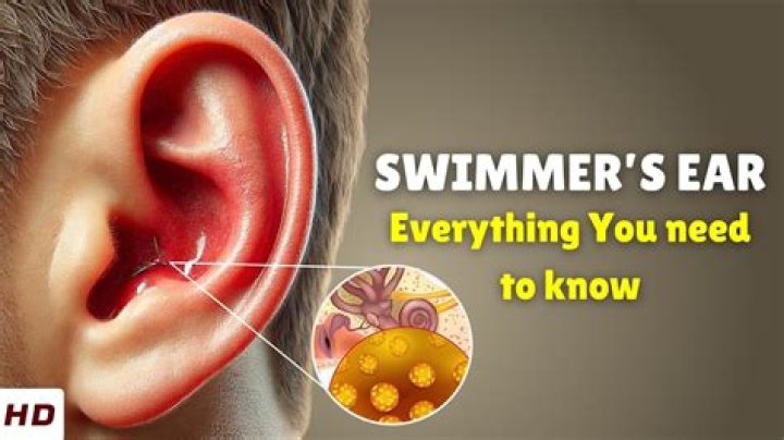 Can swimmer's ear make you sick?
