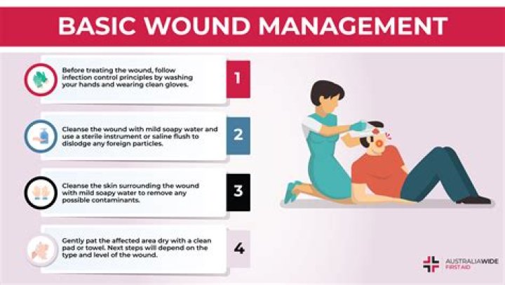 Can Tbact be used on open wounds?