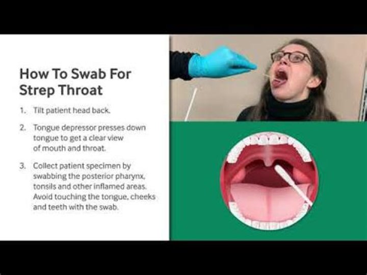 Can they test for strep throat at urgent care?
