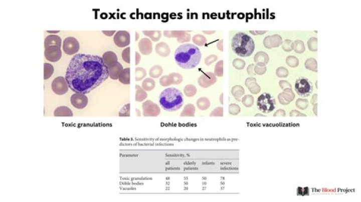 Can toxic blood be contagious?
