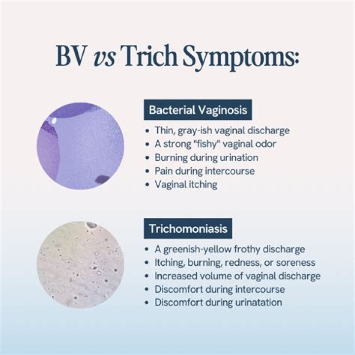 Can trich be mistaken for BV?