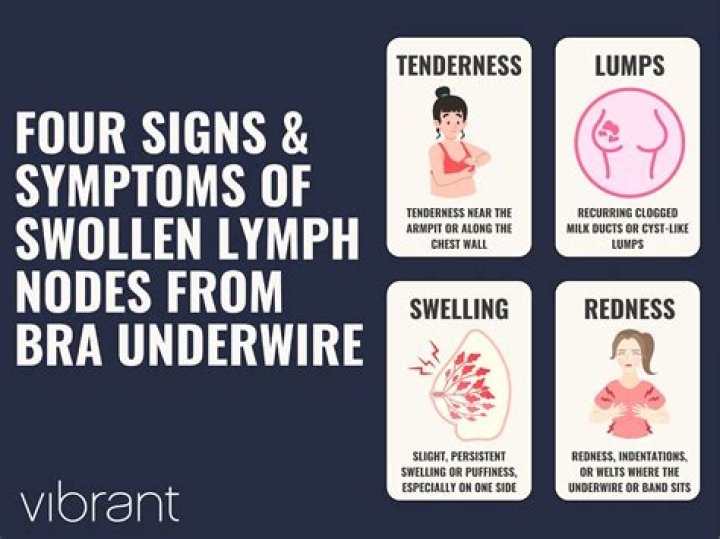 Can underwire bras cause swollen lymph nodes?