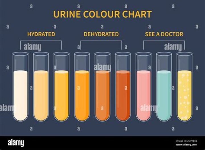 Can urine color determine dehydration?