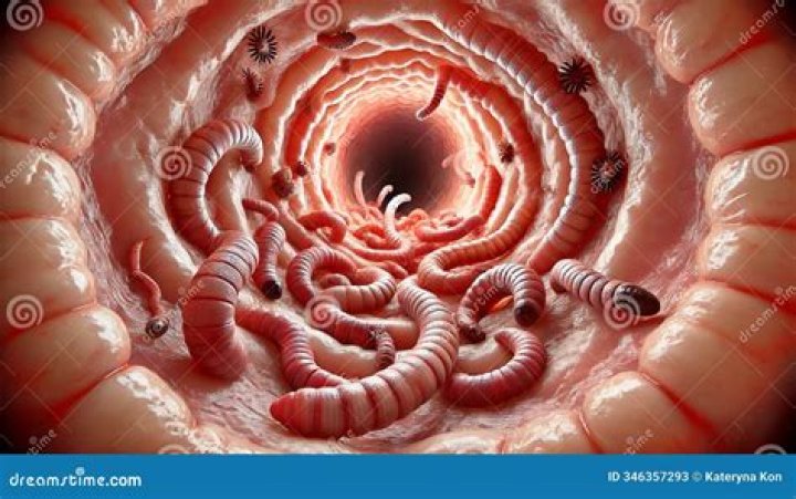 Can worms cause spasms?
