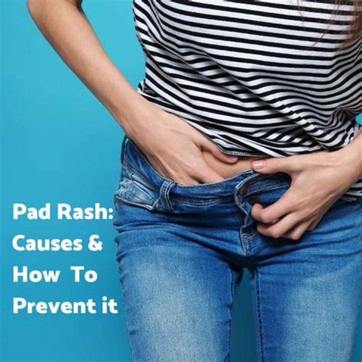 Can you be allergic to period pads?