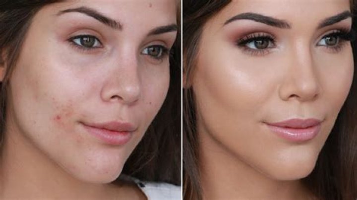 Can you cover pimples with makeup?