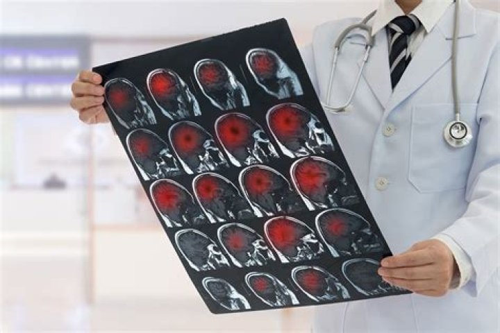 Can you fly with brain Tumours?