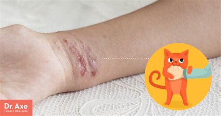 Can you get cat scratch fever from a dog?