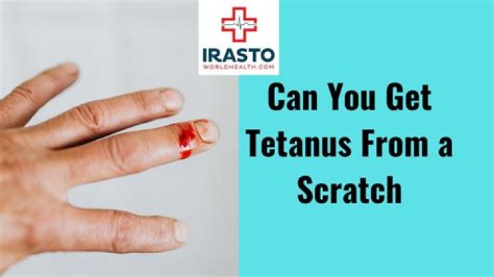 Can you get tetanus from a human scratch?