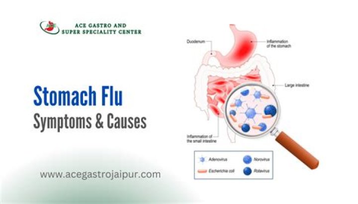 Can you get the stomach flu through the air?