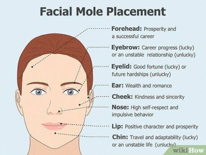 Can you have a mole on your ear?