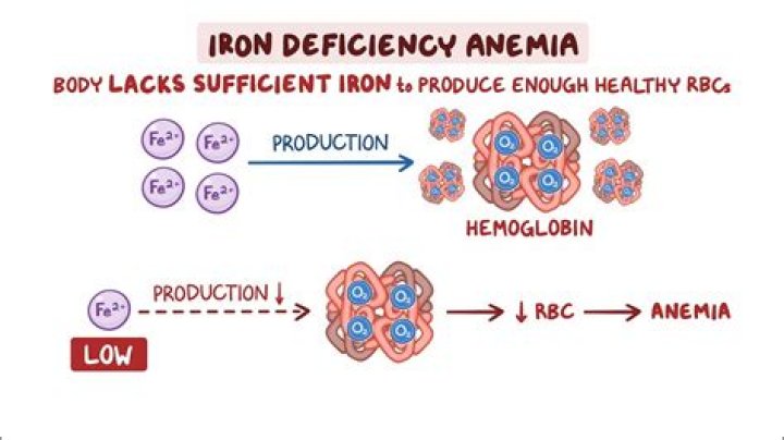 Can you have iron overload with anemia?