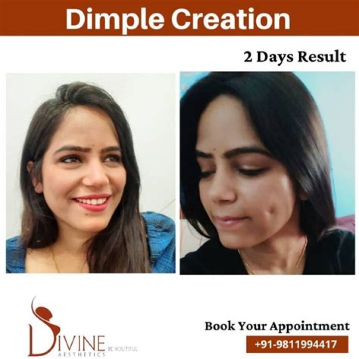 Can you remove dimples?