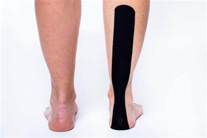 Can you tape your Achilles tendon?